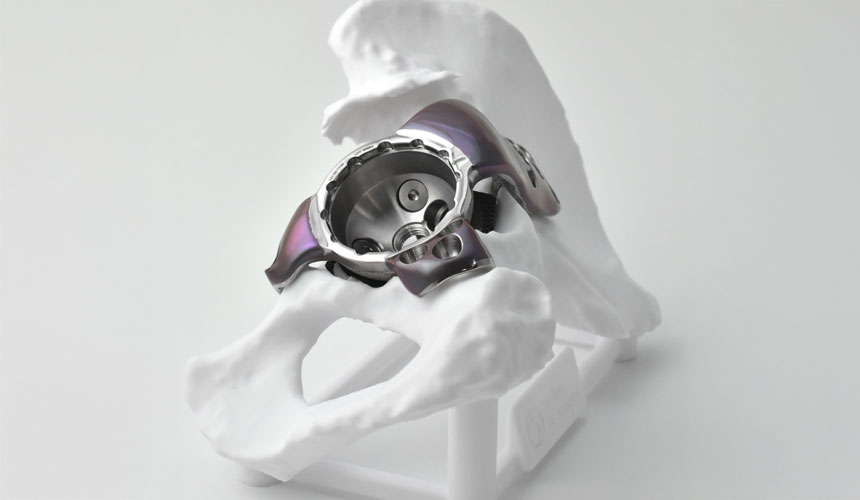 combination agluna acusure ag2 large